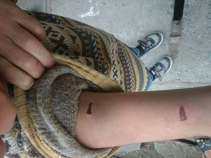 Chủ tịch thành phố Hà Nội yêu cầu làm rõ vụ bé trai 9 tuổi bị bố đẻ dùng dây điện đánh đập dã man